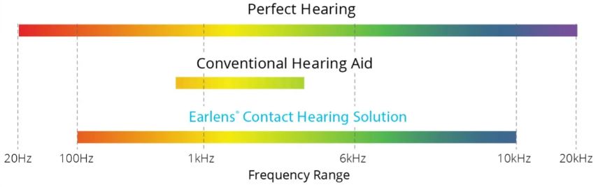 Earlens Audio Graphic Levels